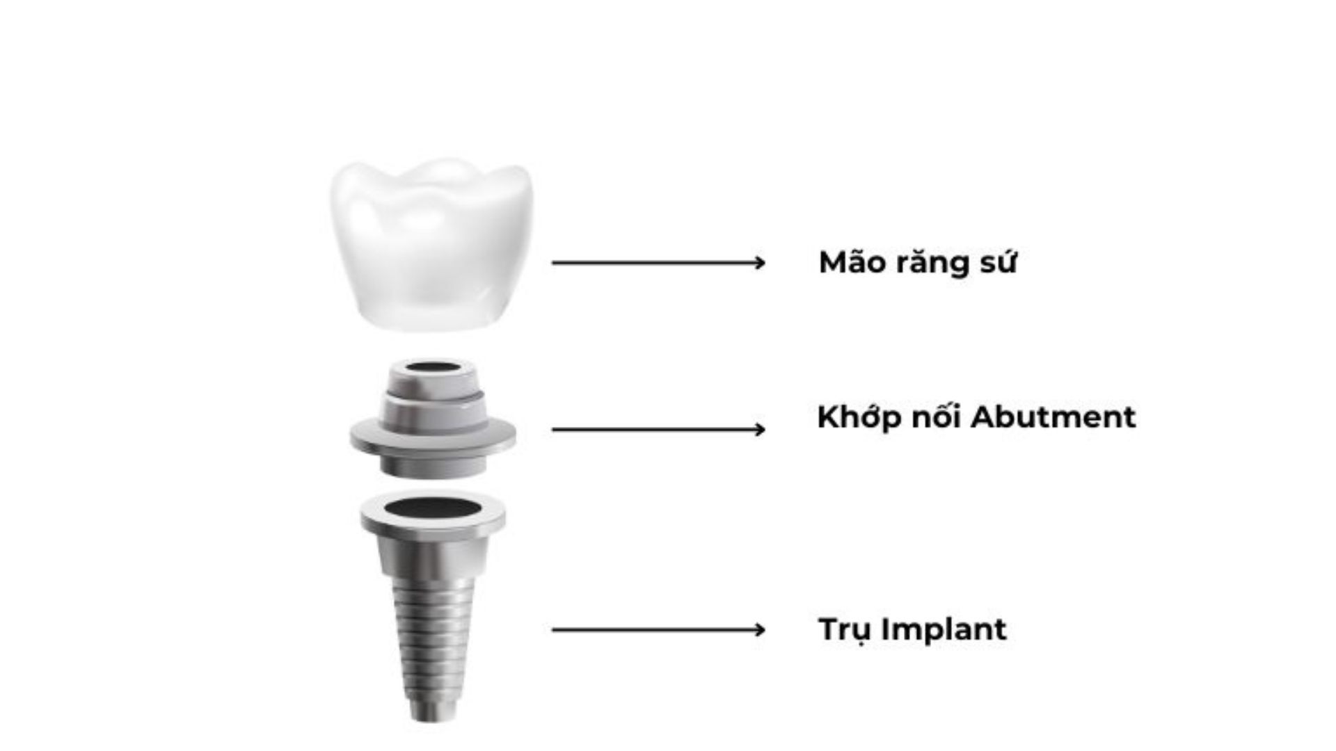 cau-tao-tru-implant-titanium