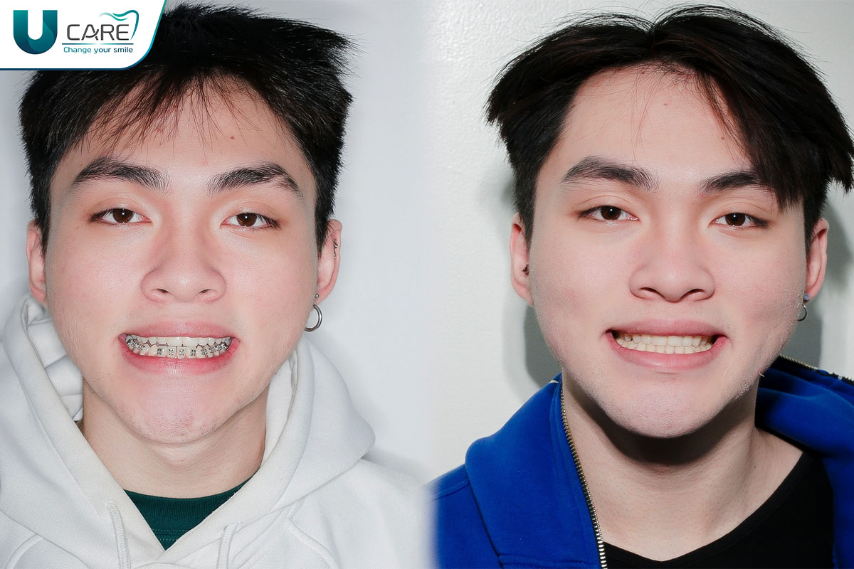 nieng-rang-sinh-vien